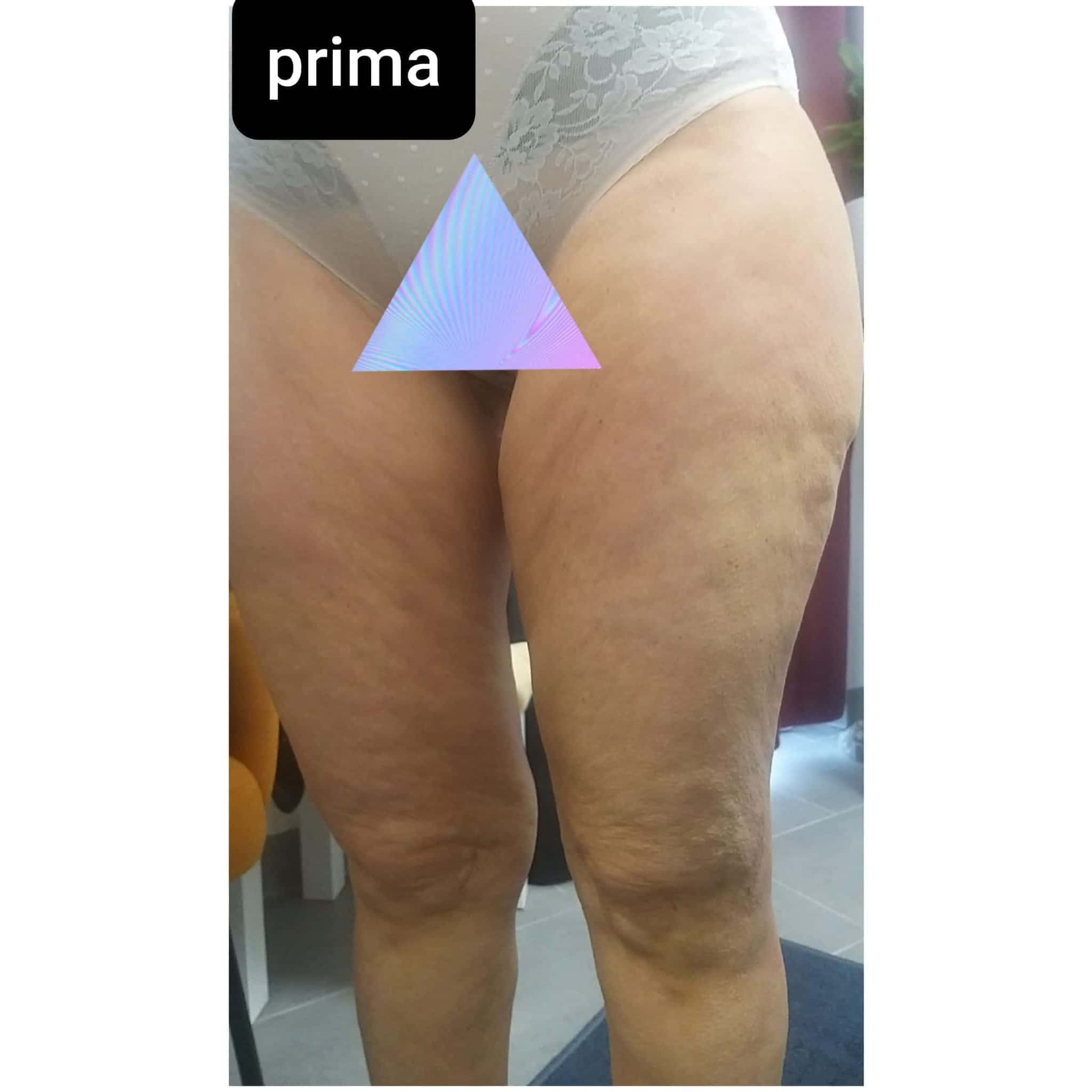 Metodo Renata França