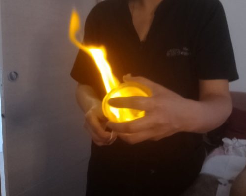 Studio Equilibra Verona Coppettazione 3